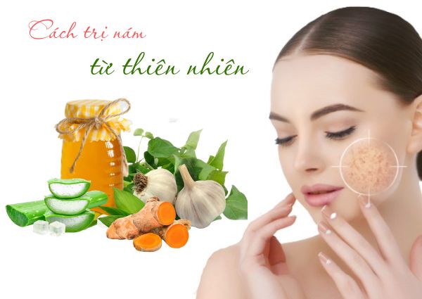 cách trị nám da mặt bằng thiên nhiên